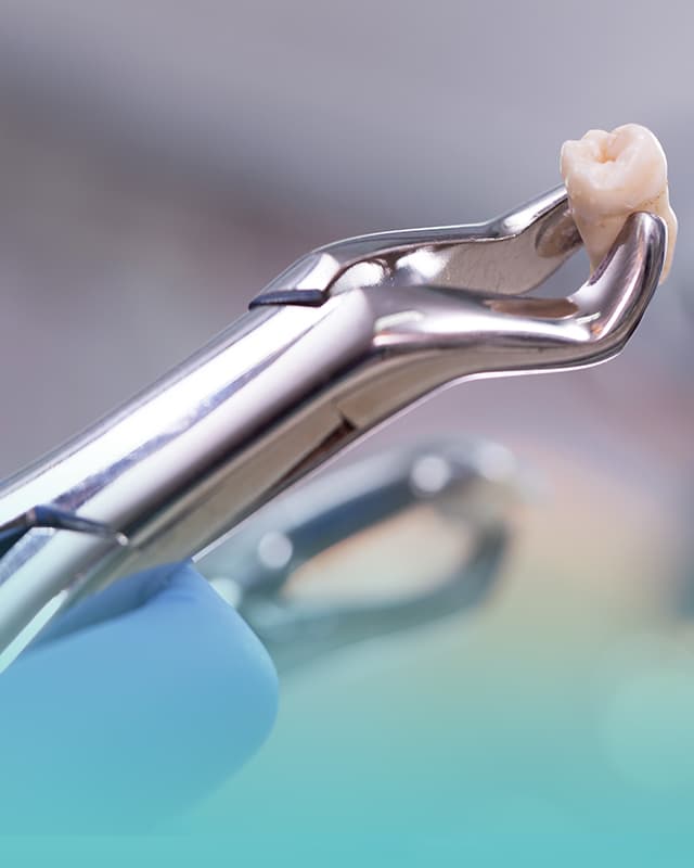 Chirurgia stomatologiczna